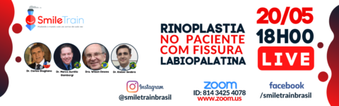 Rinoplastía en pacientes fisurados