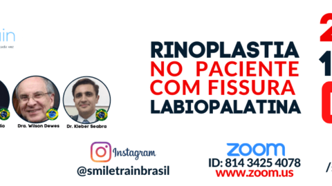 Rinoplastía en pacientes fisurados